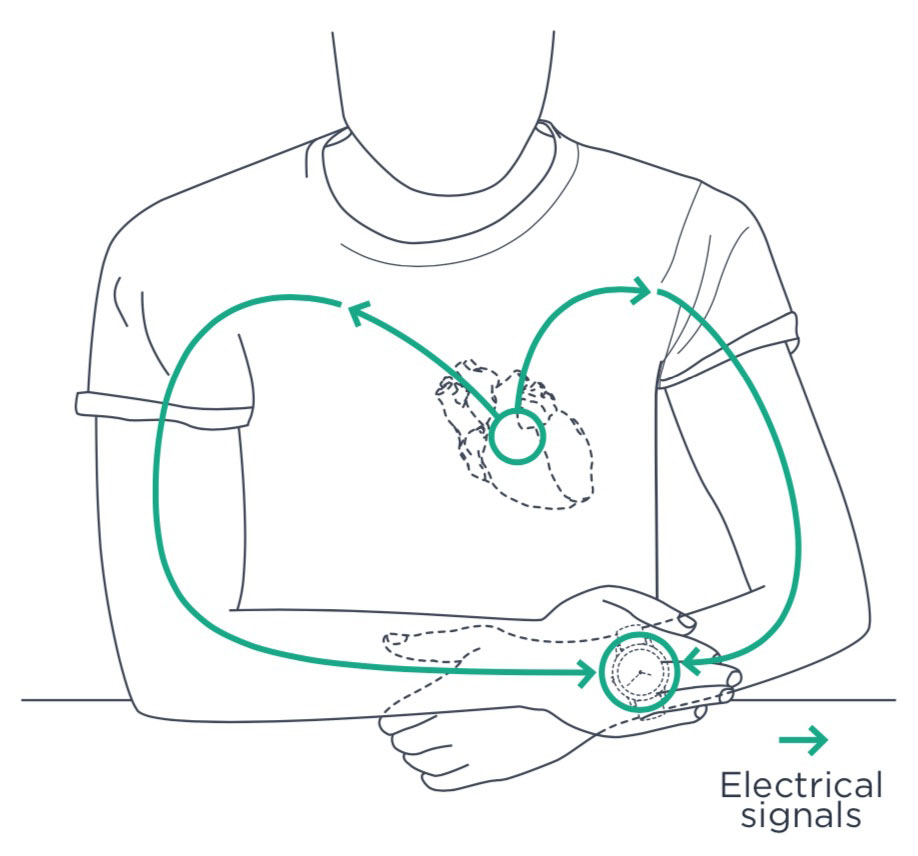 Diagram showing the closed electrical circuit during ECG measurement