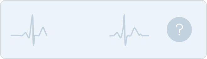 Example of an inconclusive ECG tracing