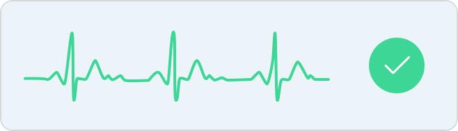 Example of a normal sinus rhythm ECG tracing
