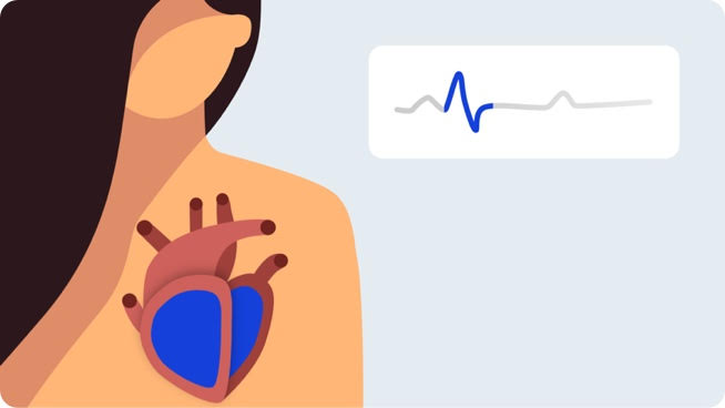 ECG signal highlighting the QRS complex